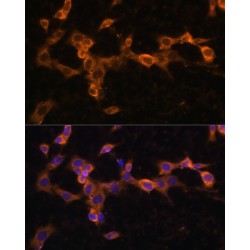 Platelet Derived Growth Factor Receptor Beta (PDGFRB) Antibody