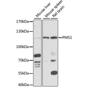 Western blot analysis of extracts of various cell lines using PMS1 Antibody (1/1000 dilution).
