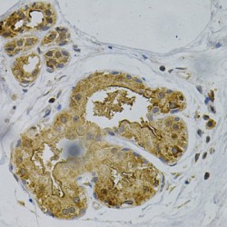 Presenilin 1 (PSEN1) Antibody