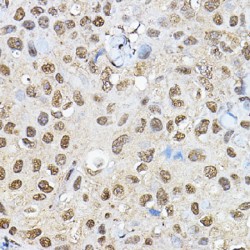 Ribosomal Protein S6 Kinase Beta 1 (RPS6KB1) Antibody