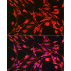 Ribosomal Protein S6 Kinase Beta 1 (RPS6KB1) Antibody