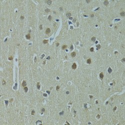 SUMO-Conjugating Enzyme UBC9 (UBE2I) Antibody