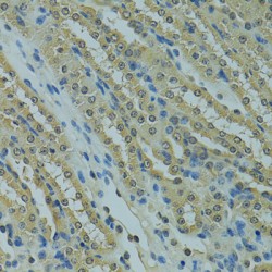 SUMO-Conjugating Enzyme UBC9 (UBE2I) Antibody