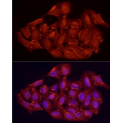 Vitamin D3 Receptor (VDR) Antibody