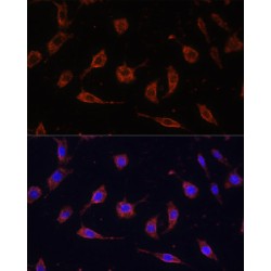 Toll-Interacting Protein (TOLLIP) Antibody