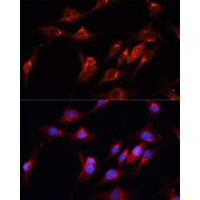 Immunofluorescence analysis of C6 cells using CUX1 Antibody (1/100 dilution). Blue: DAPI for nuclear staining.