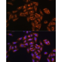 Programmed Cell Death 6-Interacting Protein (PDCD6IP) Antibody