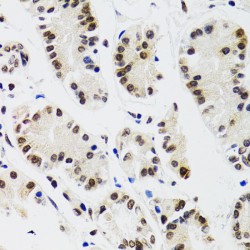 Endothelial Differentiation-Related Factor 1 (EDF1) Antibody