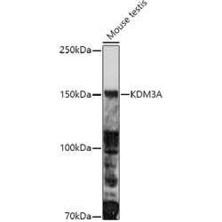 Lysine-Specific Demethylase 3A (KDM3A) Antibody