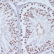 Immunohistochemistry of paraffin-embedded rat testis using DNMT3L Antibody (1/100 dilution, 40x lens). Microwave antigen retrieval was performed in 10 mM PBS buffer pH 7.2 before commencing with IHC staining protocol.