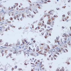 DNA Methyltransferase 3 Like (DNMT3L) Antibody