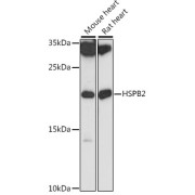 Western blot analysis of extracts of various cell lines using HSPB2 Antibody (1/1000 dilution).