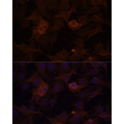 Filamin-B (FLNB) Antibody
