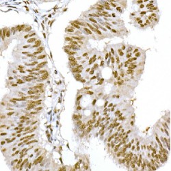 General Transcription Factor IIF, Polypeptide 1 (GTF2F1) Antibody