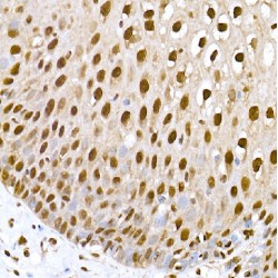 General Transcription Factor IIF, Polypeptide 1 (GTF2F1) Antibody