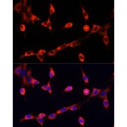 Immunofluorescence analysis of NIH/3T3 cells using CHAT Antibody (1/100 dilution). Blue: DAPI for nuclear staining.