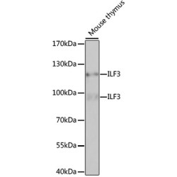 Interleukin Enhancer Binding Factor 3 (ILF3) Antibody