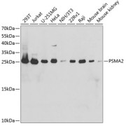 Western blot analysis of extracts of various cell lines using PSMA2 Antibody (1/1000 dilution).