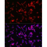Immunofluorescence analysis of SH-SY5Y cells using ADAMTS4 Antibody (1/100 dilution, 40x lens). Blue: DAPI for nuclear staining.