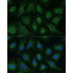 Dickkopf-Related Protein 3 (DKK3) Antibody