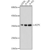 Western blot analysis of extracts of various cell lines using ACP5 Antibody (1/500 dilution).