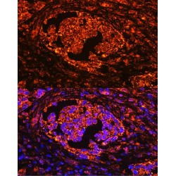 Tartrate-Resistant Acid Phosphatase 5 / TRACP5 (ACP5) Antibody
