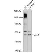 Western blot analysis of extracts of various cell lines using OAS1 Antibody (1/3000 dilution).