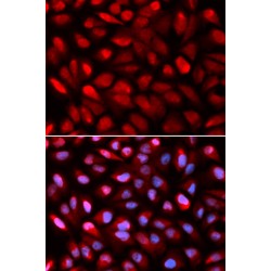 Poly(RC) Binding Protein 2 (PCBP2) Antibody