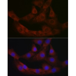 Bone Marrow Proteoglycan (PRG2) Antibody