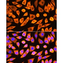 40S Ribosomal Protein S3 (RPS3) Antibody