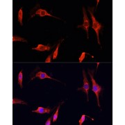 Immunofluorescence analysis of C6 cells using DNASE1 Antibody (1/100 dilution, 40x lens). Blue: DAPI for nuclear staining.