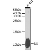 Western blot analysis of extracts of A-431 cells using IL8 Antibody (1/1000 dilution).