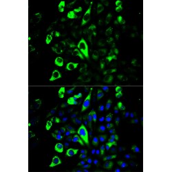 Granzyme B (GZMB) Antibody
