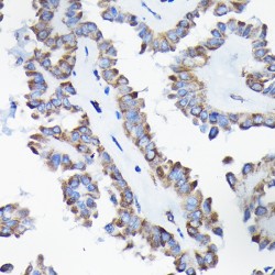 Apoptosis Inducing Factor 1, Mitochondrial (AIFM1) Antibody