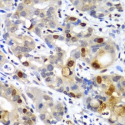 Small Ubiquitin Related Modifier Protein 2 (SUMO2) Antibody