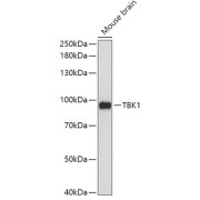 Western blot analysis of extracts of Mouse brain using TBK1 Antibody (1/1000 dilution).