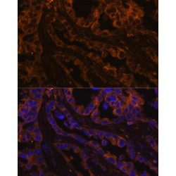Keratin, Type II Cytoskeletal 7 (KRT7) Antibody
