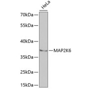 Western blot analysis of extracts of HeLa cells using MAP2K6 Antibody (1/1000 dilution).