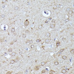 Neural Wiskott-Aldrich Syndrome Protein (WASL) Antibody