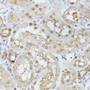 Immunohistochemistry of paraffin-embedded Rat kidney using TPI1 Antibody (1/100 dilution, 40x lens).