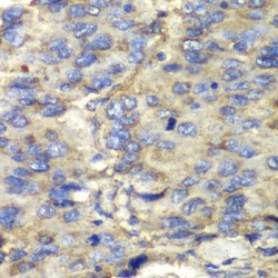 Succinate Dehydrogenase Complex Subunit A (SDHA) Antibody