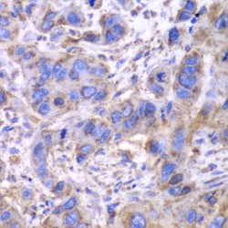 Succinate Dehydrogenase Complex Subunit A (SDHA) Antibody