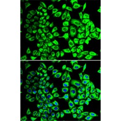 Succinate Dehydrogenase Complex Subunit A (SDHA) Antibody