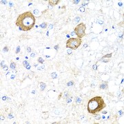 abx002032