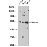 Western blot analysis of extracts of various cell lines using TRIM38 Antibody (1/1000 dilution).