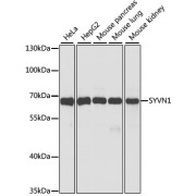 Western blot analysis of extracts of various cell lines using SYVN1 Antibody (1/1000 dilution).