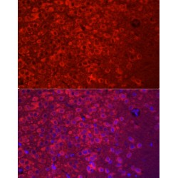 Amyloid Beta Precursor Like Protein 1 (APLP1) Antibody