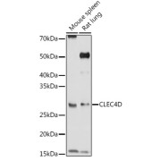 Western blot analysis of extracts of various cell lines using CLEC4D Antibody (1/1000 dilution).
