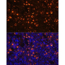 C-Type Lectin Domain Family 4 Member D (CLEC4D) Antibody