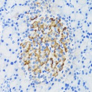 abx002066